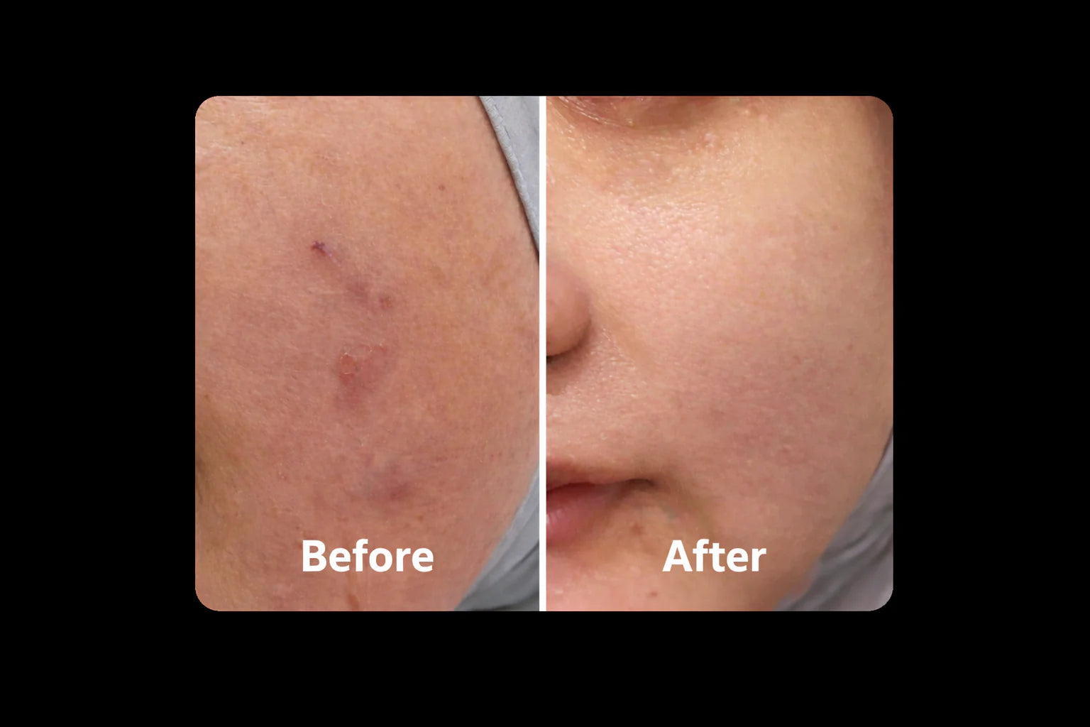 ANAAKA Europe